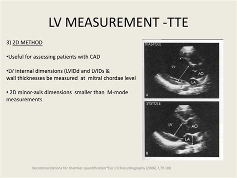 lv wall thickness echo measurement.